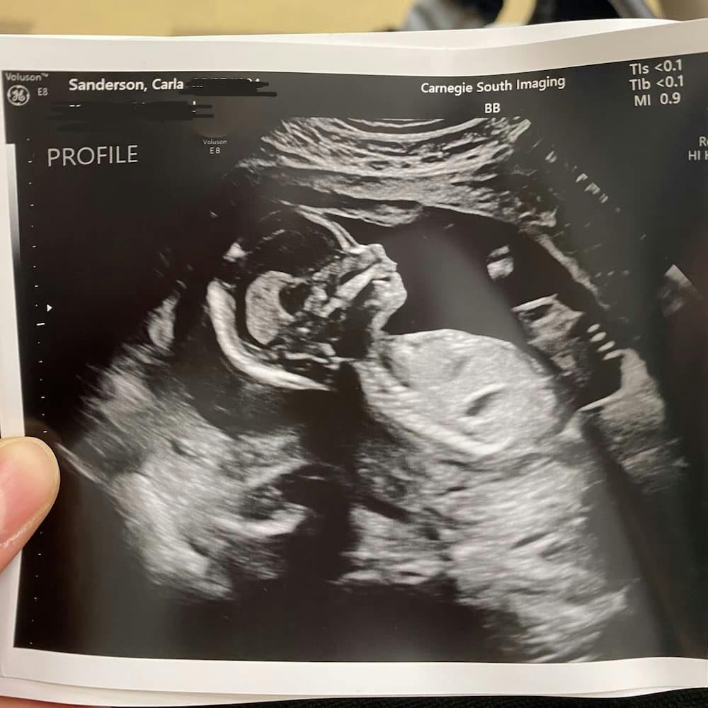 Photograph of an ultrasound scan
